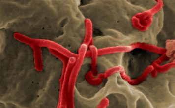 HISTORIAS DE LA HISTORIA: El ébola Créditos a su autor. El propietario de esta imagen es el titular de sus derechos.