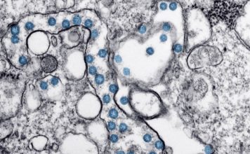 HISTORIAS DE LA HISTORIA: CORONAVIRUS (Parte II) Créditos a su autor. El propietario de esta imagen es el titular de sus derechos.